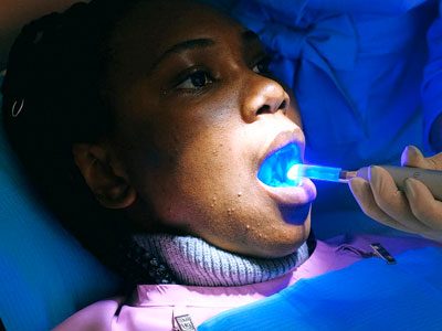 Patient receiving a cosmetic teeth whitening treatment at C.Metric in Dbayeh